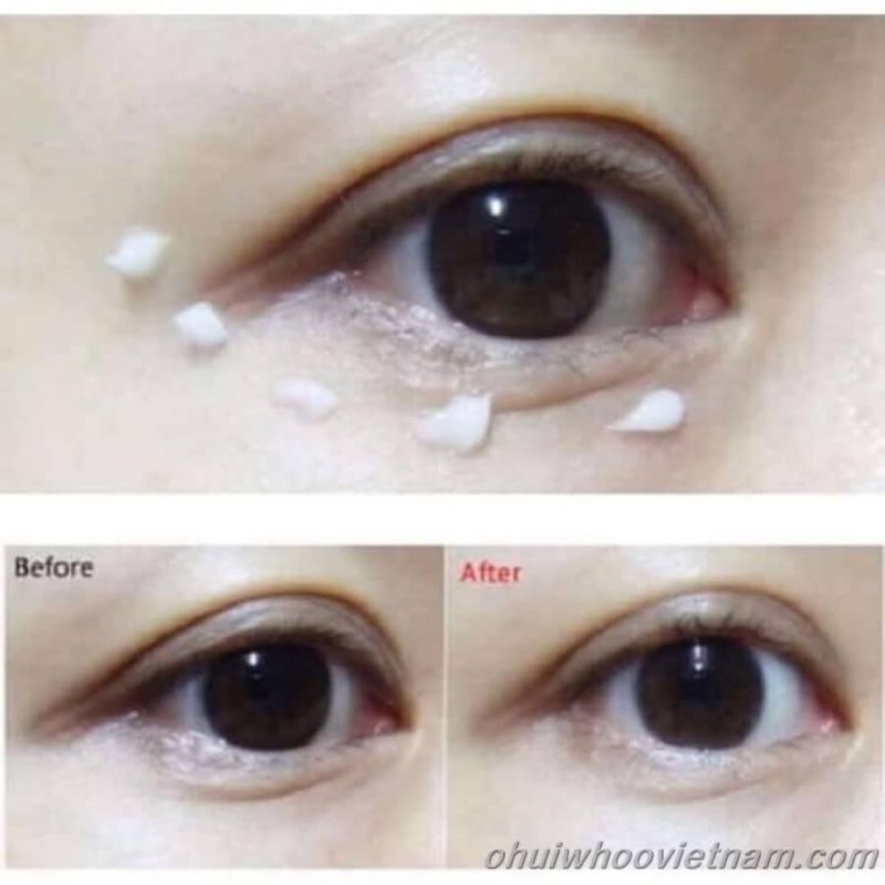 Bộ Kem mắt Su:m37 LosecSumma Elixir Eye Cream tăng 200% dung tích